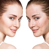 کاربردهای روش میکرونیدلینگ کاربردهای روش میکرونیدلینگ
